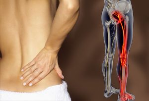 Top-rated Sciatica Online Program For Pain